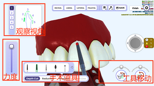 牙医模拟器