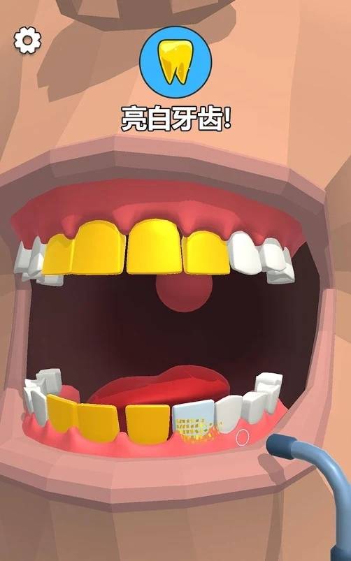 拔牙吗我贼6Dentist Bling