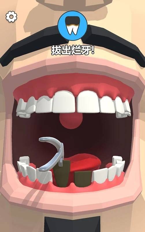 拔牙吗我贼6Dentist Bling